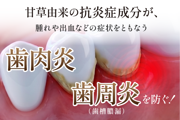 甘草由来の抗炎症成分が歯肉炎・歯周炎（歯槽膿漏）を防ぐ