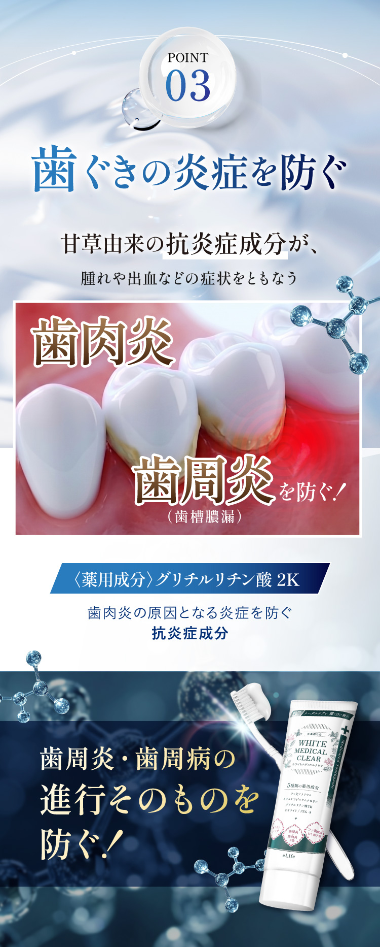 有効成分03 グリチルリチン酸2K。歯ぐきの炎症を防ぐ、甘草由来の抗炎症成分が歯肉炎・歯周炎(歯槽膿漏)を防ぐ、歯周炎・歯周病の進行そのものを防ぐ